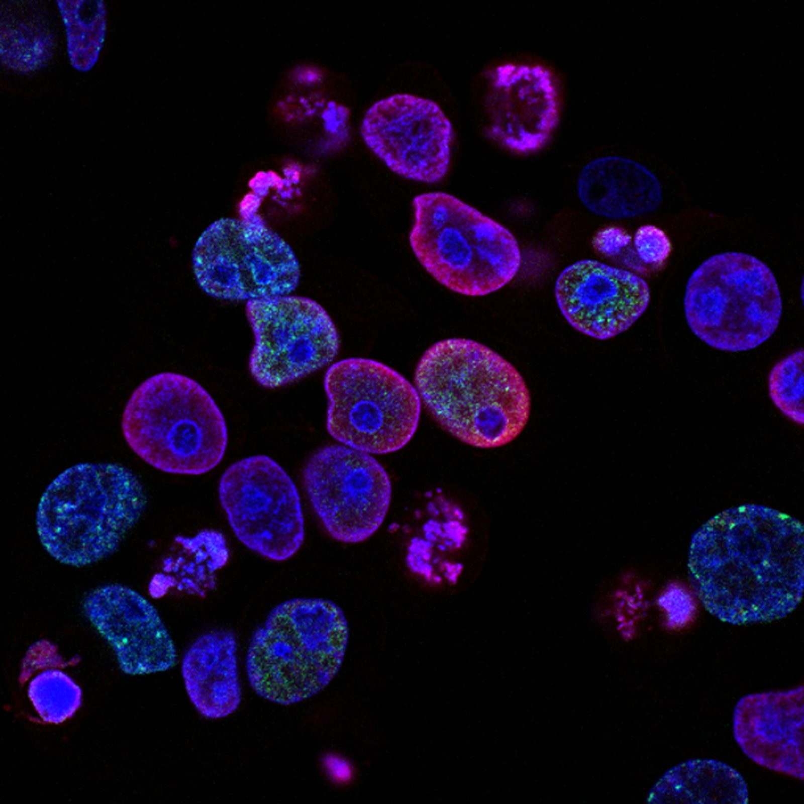 March is Colorectal Cancer Awareness Month featured image