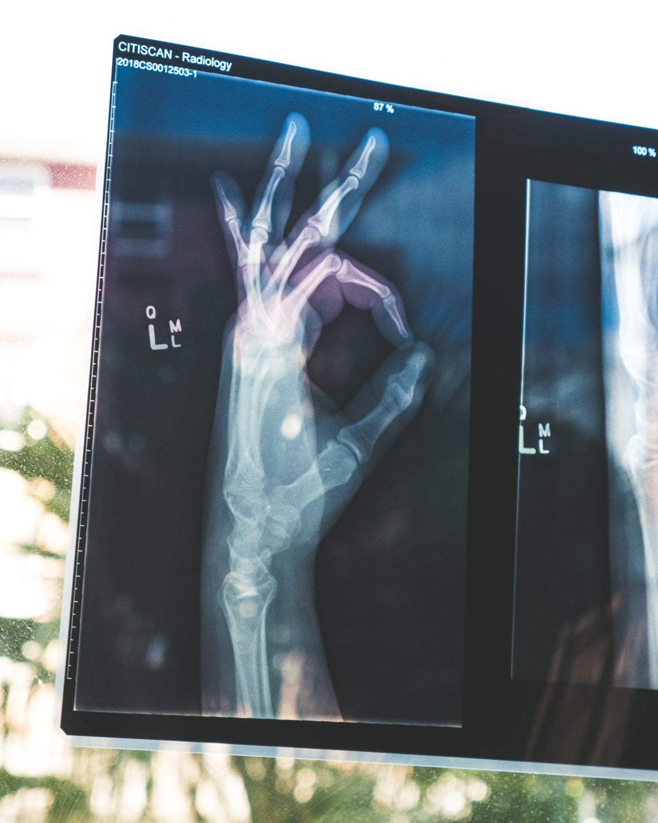 Osteoporosis Awareness Month featured image