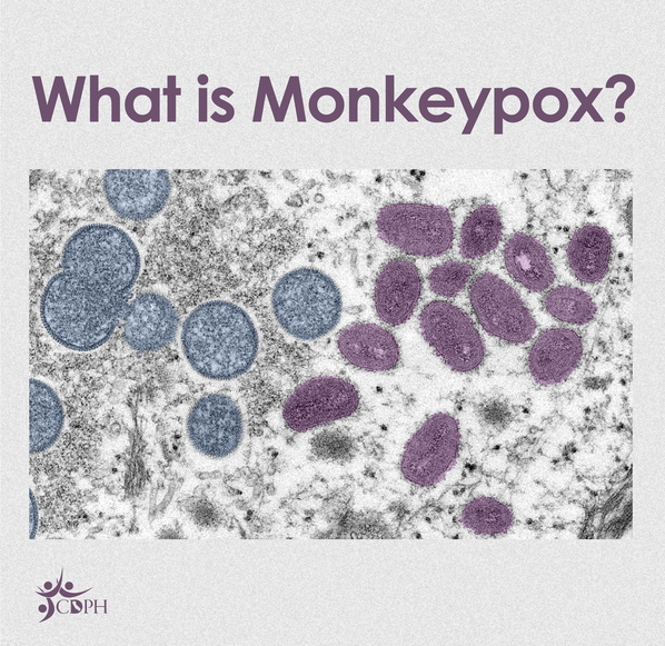 Monkeypox Update featured image