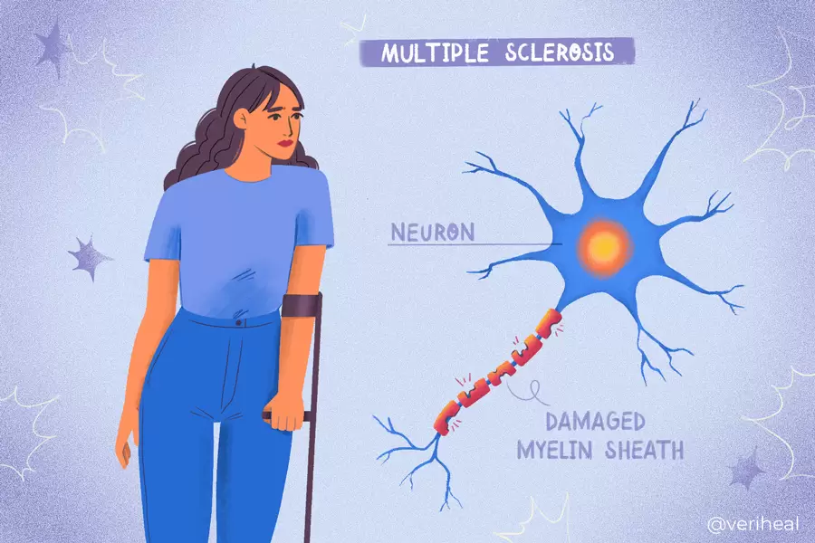 Multiple Sclerosis Awareness Month featured image